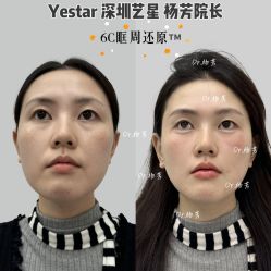 -深圳艺星医疗美容医院