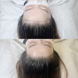 -久匠·纹眉纹绣半永久