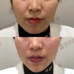 -广州健丽·去眼袋医疗美容机构
