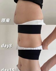 -Lily纤美·科技减脂中心