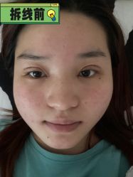 -素美医疗美容·西南眼鼻整形·修复基地