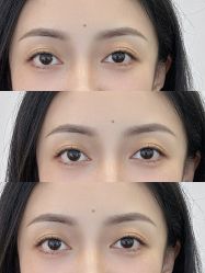 点击看大图 -杨益美学·野生眉半永久纹眉发际线