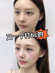 -深圳艺星医疗美容医院