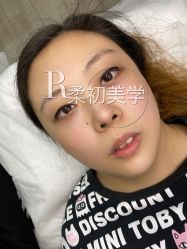 -RC半永久纹眉纹发际线