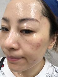 -针美汇欧邦医疗美容