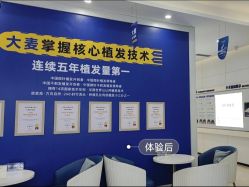 -大麦微针植发全国连锁