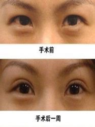 -美莱医学美容医院