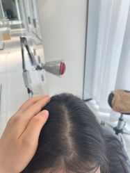 -大麦微针植发丨全国连锁