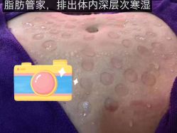 -娇诗尼亚减肥瘦身经络养生