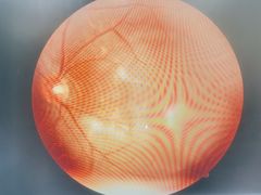 -宝岛眼镜(苏州浒关店)