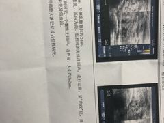 -广州仁爱天河医院体检中心