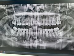 -欢乐口腔(望京分院)