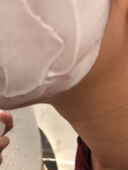 -美瑞莎创美医疗美容