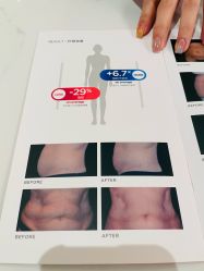 -Fundi张玉珊修身堂·indiba·BTL科技瘦身