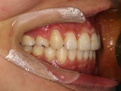 -同步齿科·数字化正畸种植口腔中心(珠海店)