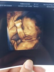 -北京俪婴妇产医院(朝阳大悦城店)