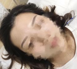 -Doris多里斯半永久纹眉·SMP纹发·发际线