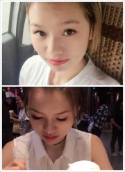 -北京米扬丽格医疗美容·联合丽格鼻整形中心