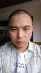 点击看大图 -大麦微针植发丨全国连锁