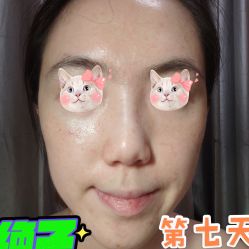 -洁铭新加坡医美