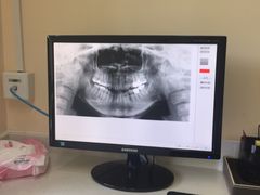 -爱贝口腔·牙周诊疗·种植修复中心