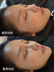 点击看大图 -AURAS璈然科技护肤中心