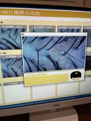 -丝客富脱发养发头皮馆