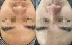 -SKIN79皮肤管理中心