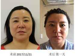 -丰联丽格医疗美容·联合丽格眼整形中心