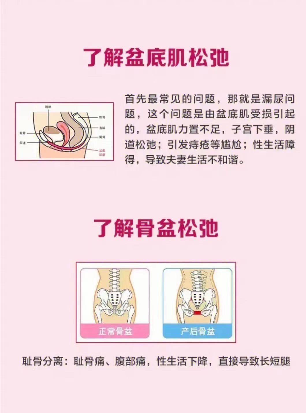 产后宫腔分离图片