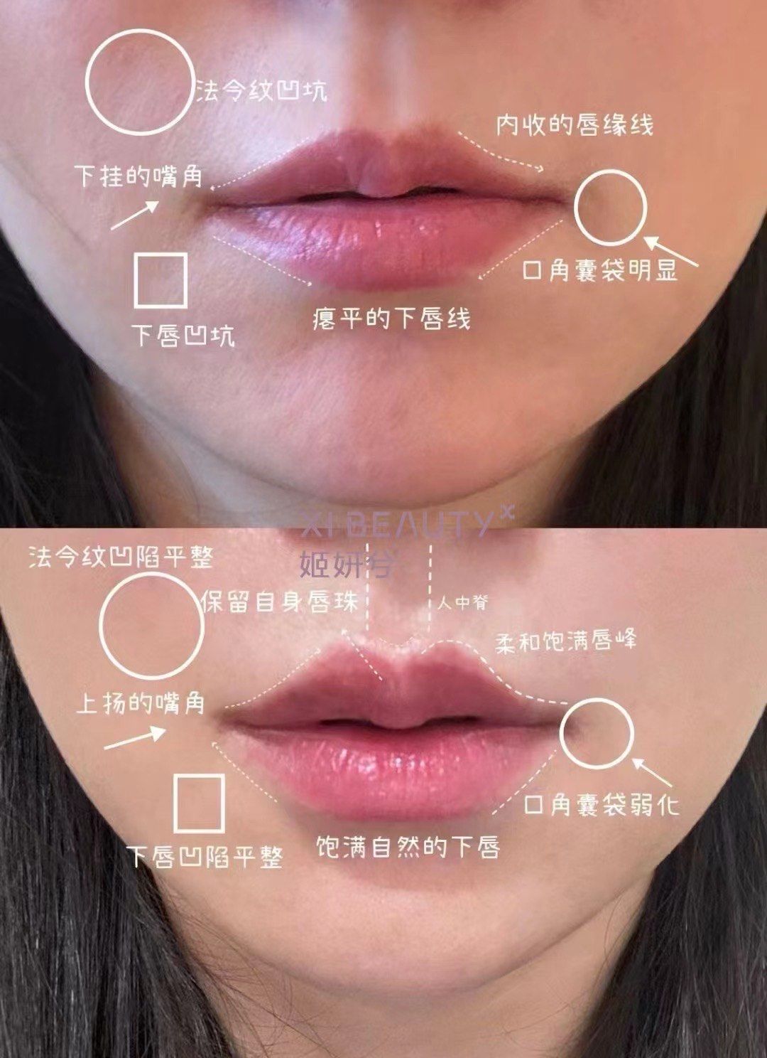 即刻焕发嘟嘟唇