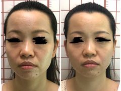 -修申骨雕小颜脊柱骨盆管理产后修复