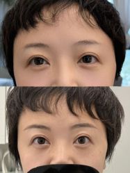 -张小野·专业半永久纹眉