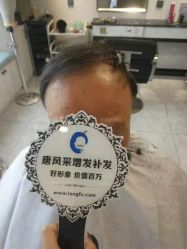 -唐风采假发补发定制