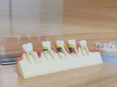 -上海仁爱医院口腔科 · 种植