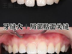 -绿地·中山里