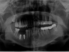 -爱贝口腔·牙周诊疗·种植修复中心