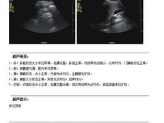 -普惠健康体检中心(西安未央体检中心)