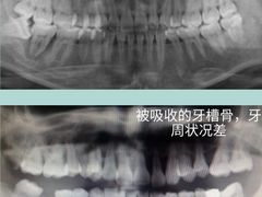 -团圆口腔·种植中心(锦江院区)