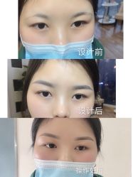 -久匠半永久纹眉