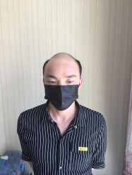 -极客侠男士假发定制补发