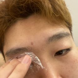 体验前-联合丽格·张菡丽格医疗美容