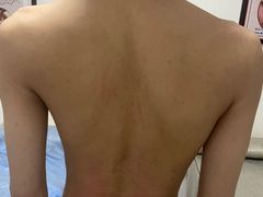 -张钰强中医正骨推拿连锁(华发商都店)