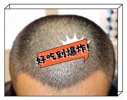 -大麦微针植发全国连锁