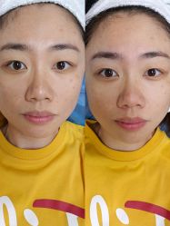 -伊美尔医疗美容医院