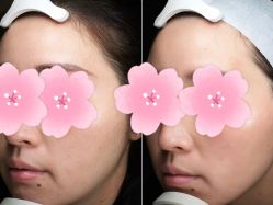 -Yestar重庆艺星医疗美容医院