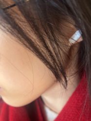 体验前-四川米兰柏羽医学美容医院