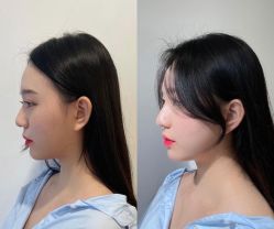 -依格宝IL COLPO明星店