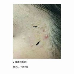 -美肤盾祛痘·问题肌头疗管理中心