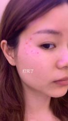 体验后-深圳美莱医疗美容医院